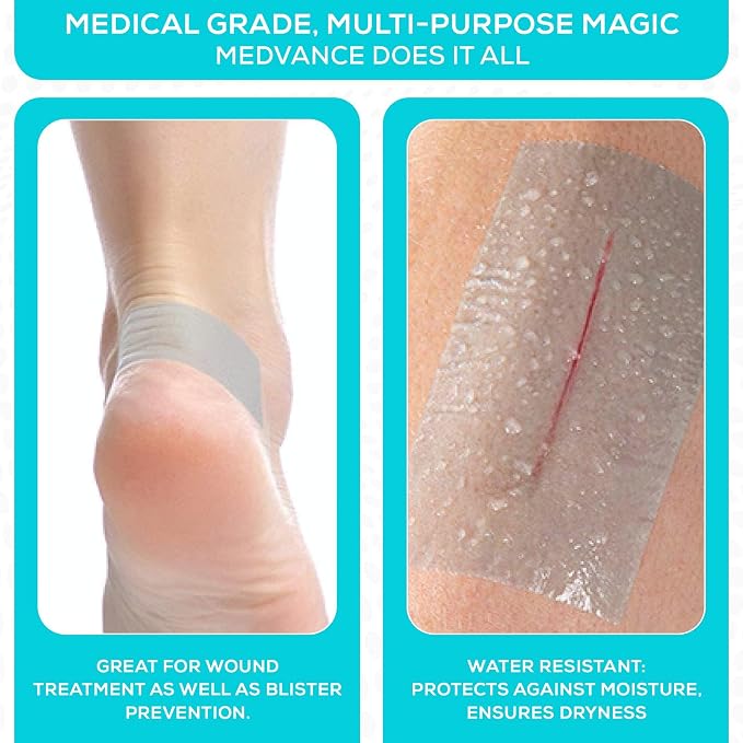 MedVance Silicone Tape 2" Wide Soft - Image 6
